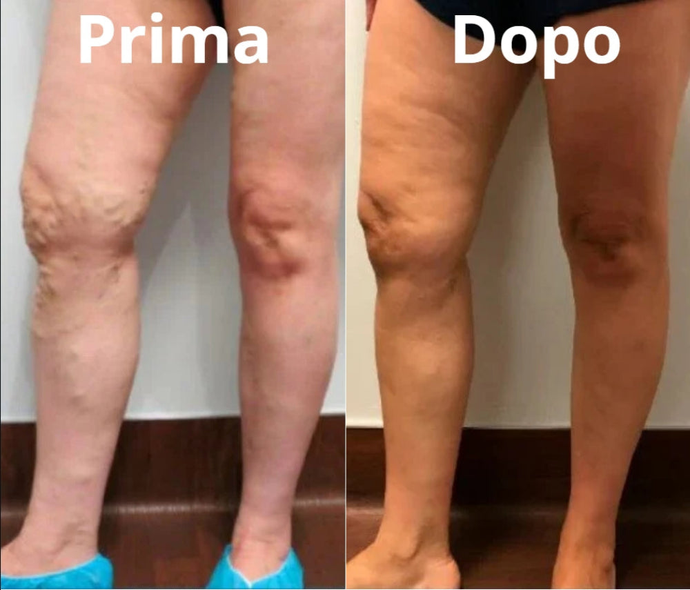 Relaxane™| Tappeto massaggiante